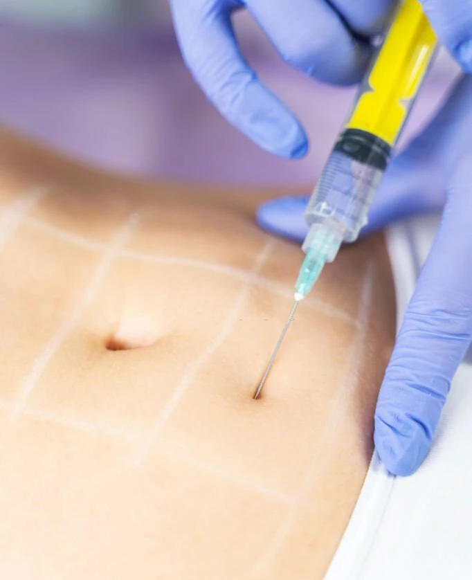 lipo injections